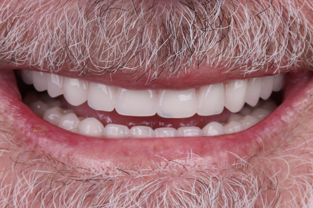 protocolo dentário