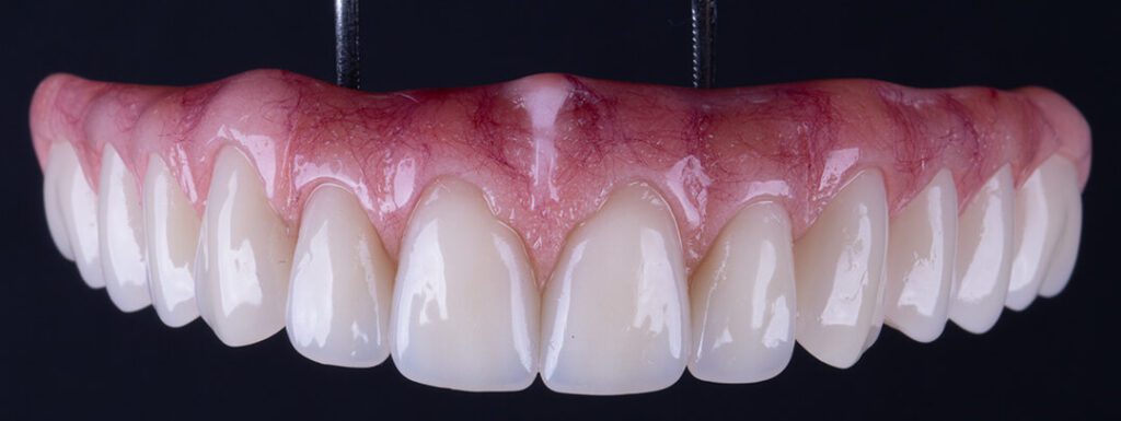 protocolo dentário